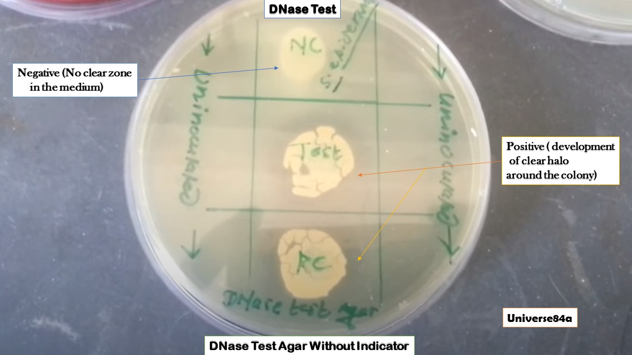 DNase آزمایش
