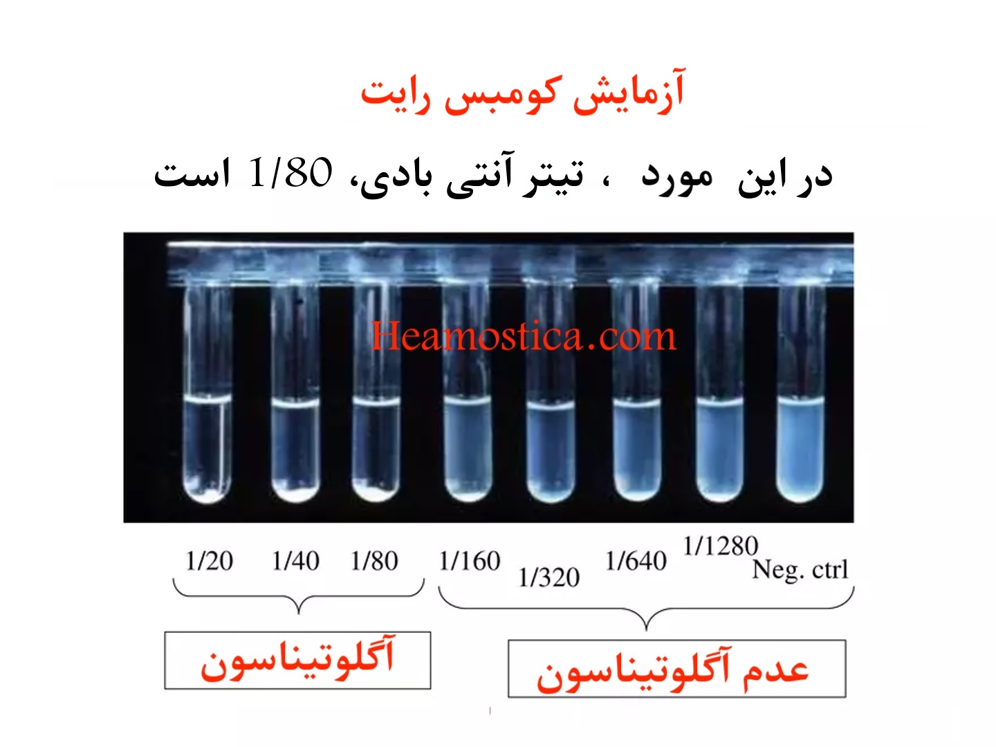 آزمایش کومبس رایت