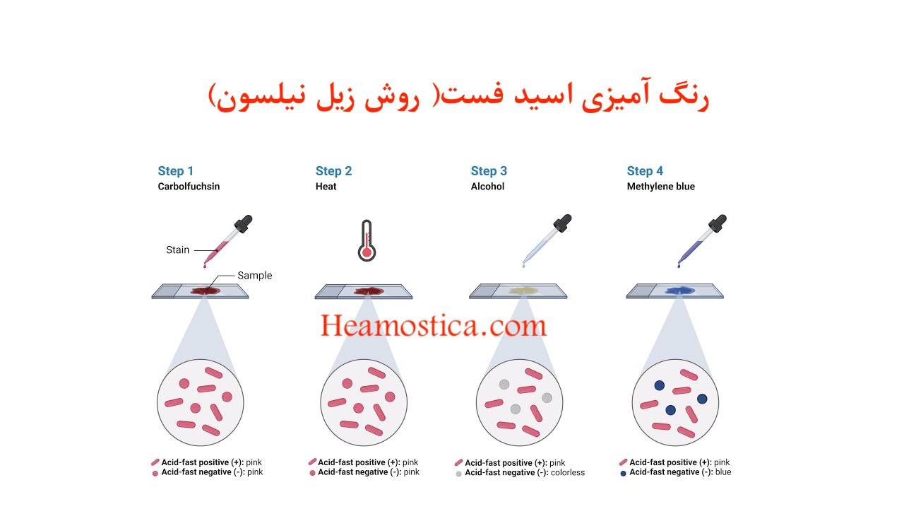 کنترل کیفی رنگ آمیزی زیل نلسون
