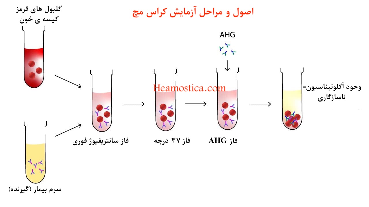 روش انجام آزمایش کراس مچ