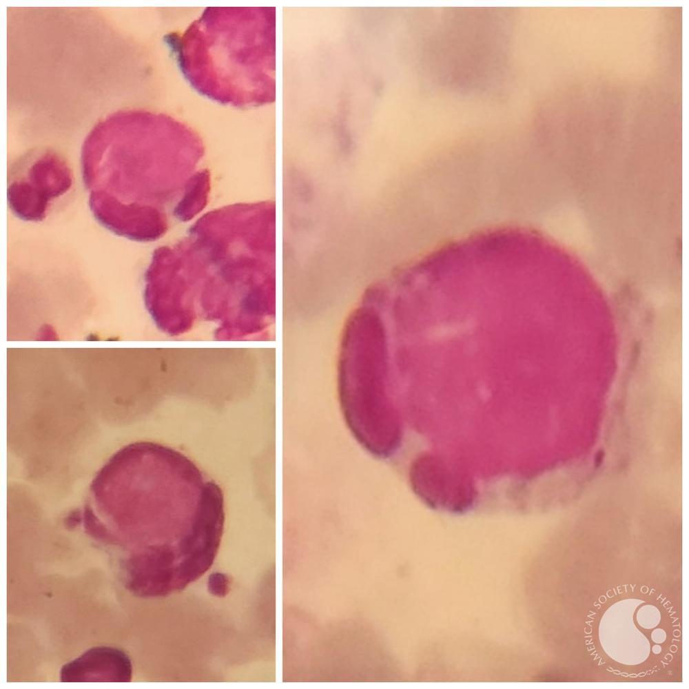 روش انجام آزمایش LE Cell