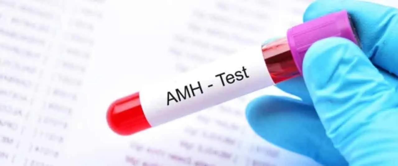 آزمایش AMH چیست