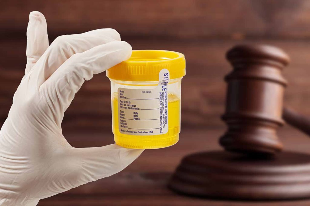 آزمایش اعتیاد ازدواج و استخدام