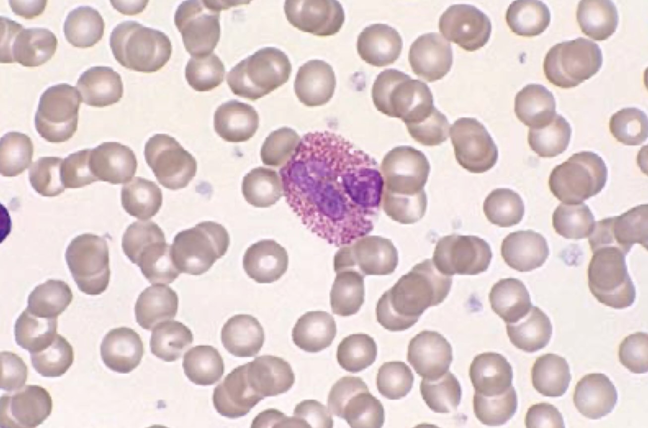 ائوزینوفیل