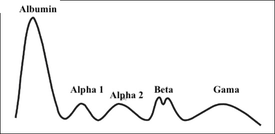 الکتروفورز پروتئین
