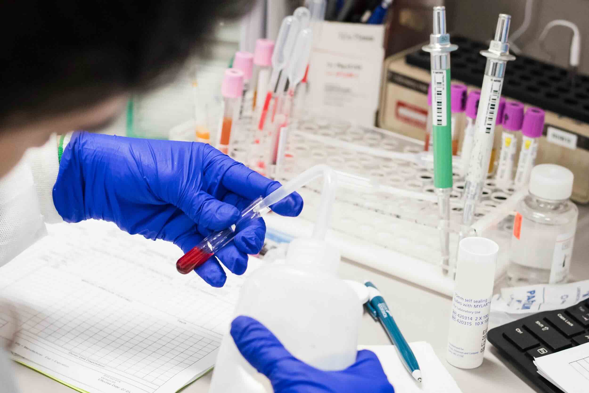 ایمونوهماتولوژی