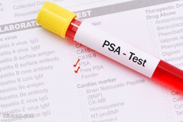 تفاوت آزمایش PSA و Free PSA
