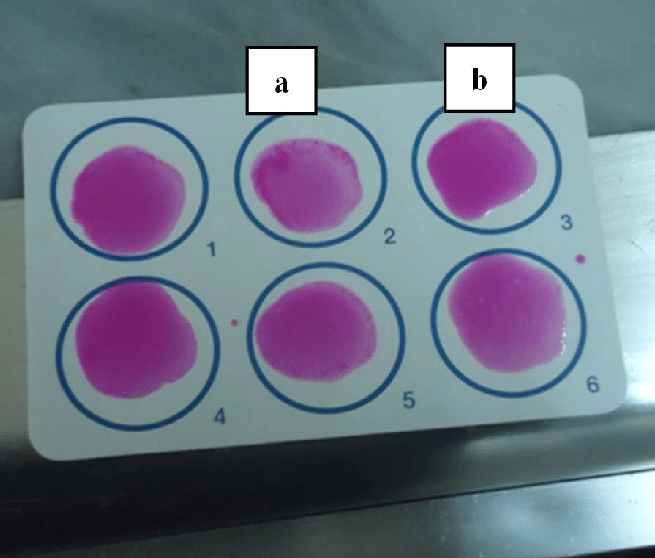 روش انجام آزمایش رز بنگال