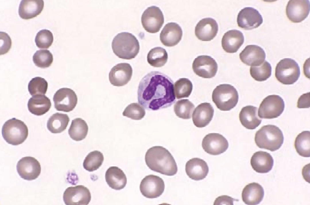 آموزش دیف هماتولوژی