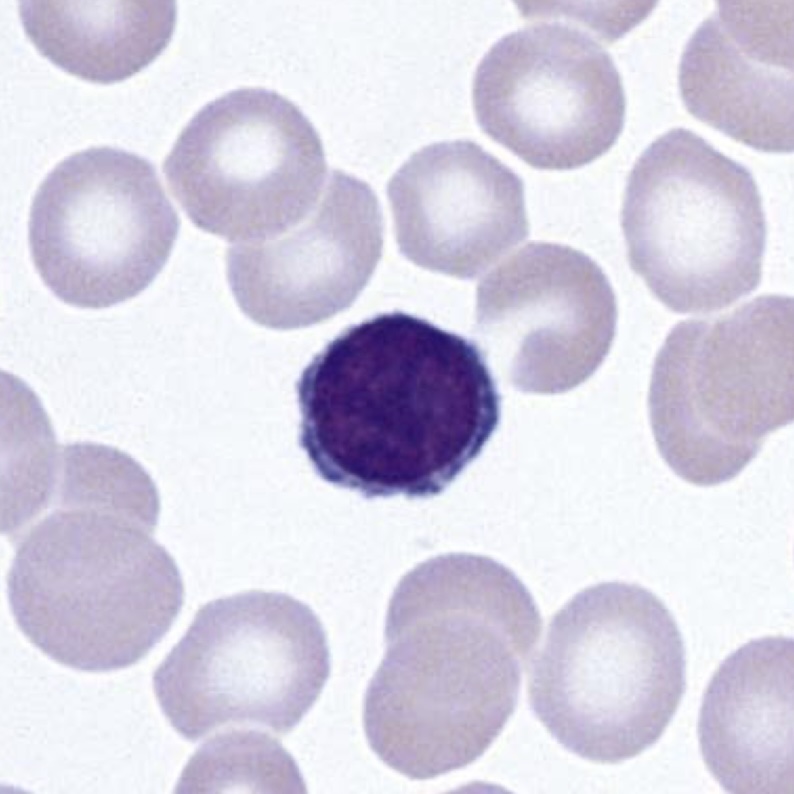 آموزش دیف هماتولوژی