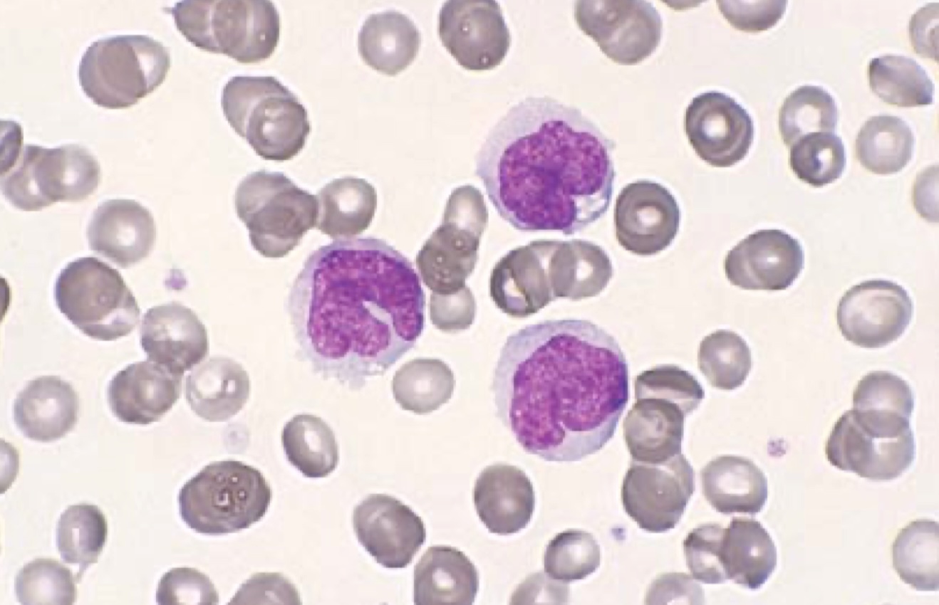 آموزش دیف هماتولوژی