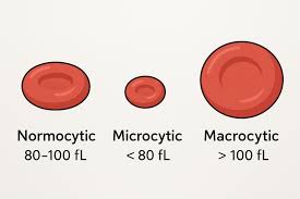 میزان نرمال mcv و mch