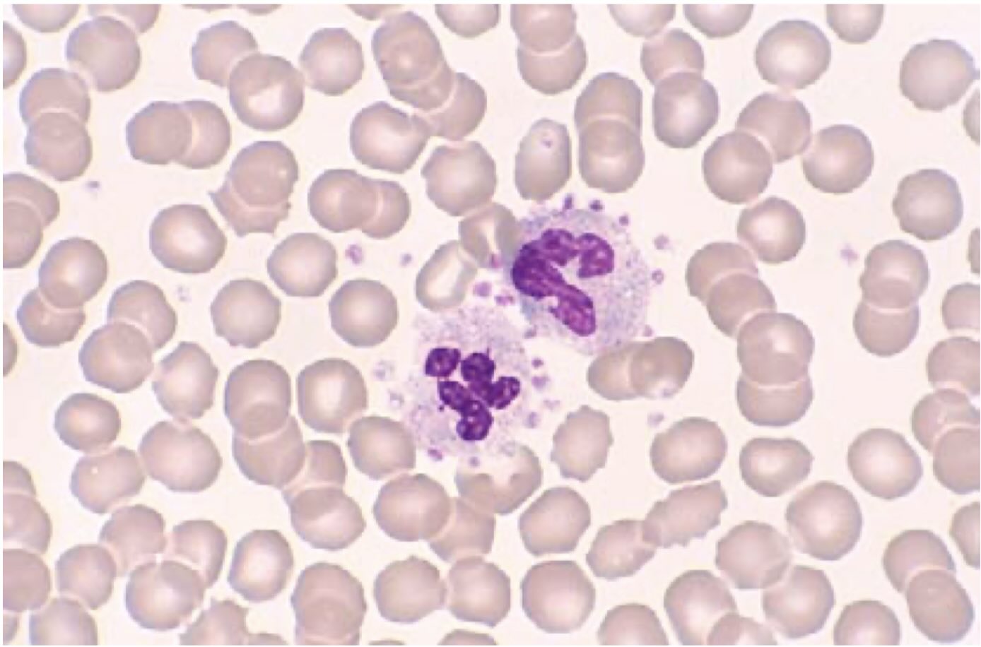 پدیده اقماری پلاکت