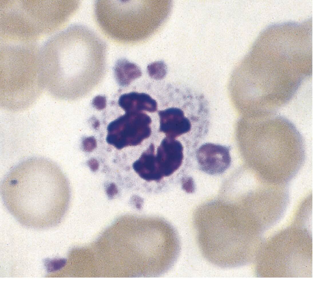 پدیده اقماری پلاکت