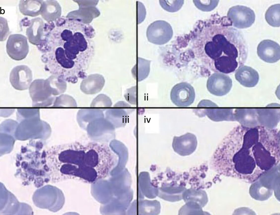 پدیده اقماری پلاکت