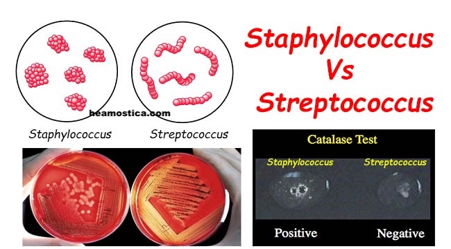 افتراق استافیلوکوک از استرپتوکوک