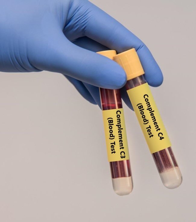 آزمایش کمپلمان