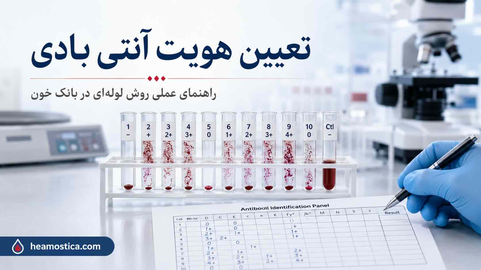 تعیین هویت آنتی بادی