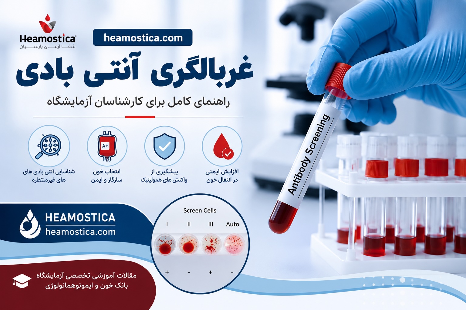 غربالگری آنتی بادی