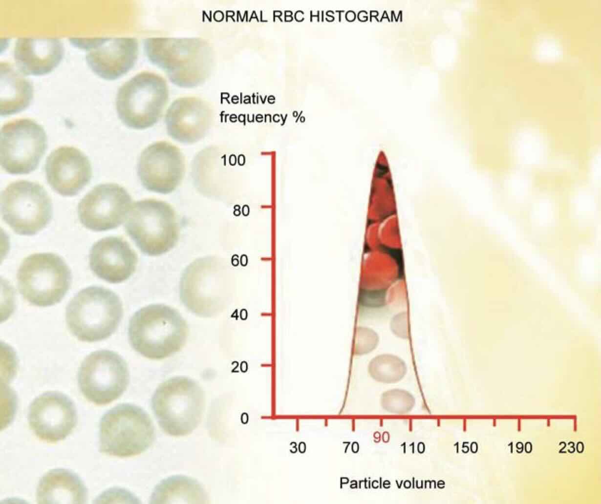 هیستوگرام نرمال RBC