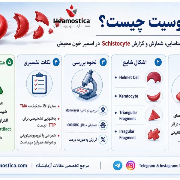 شيستوسيت جيست