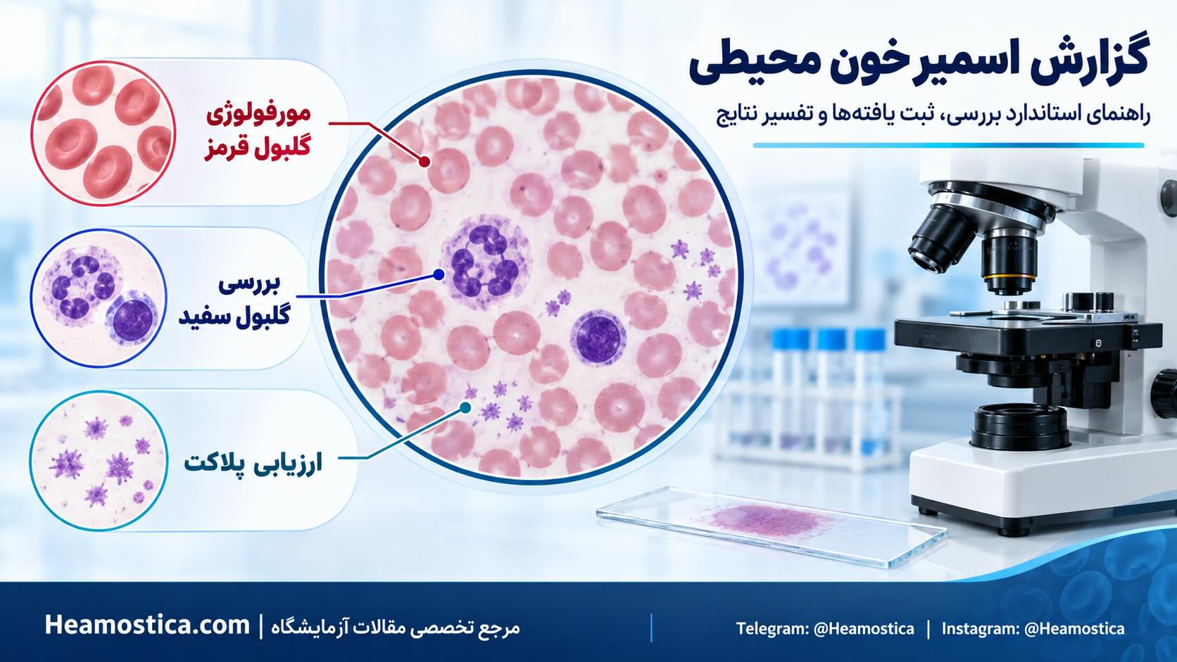گزارش اسمیر خون محیطی