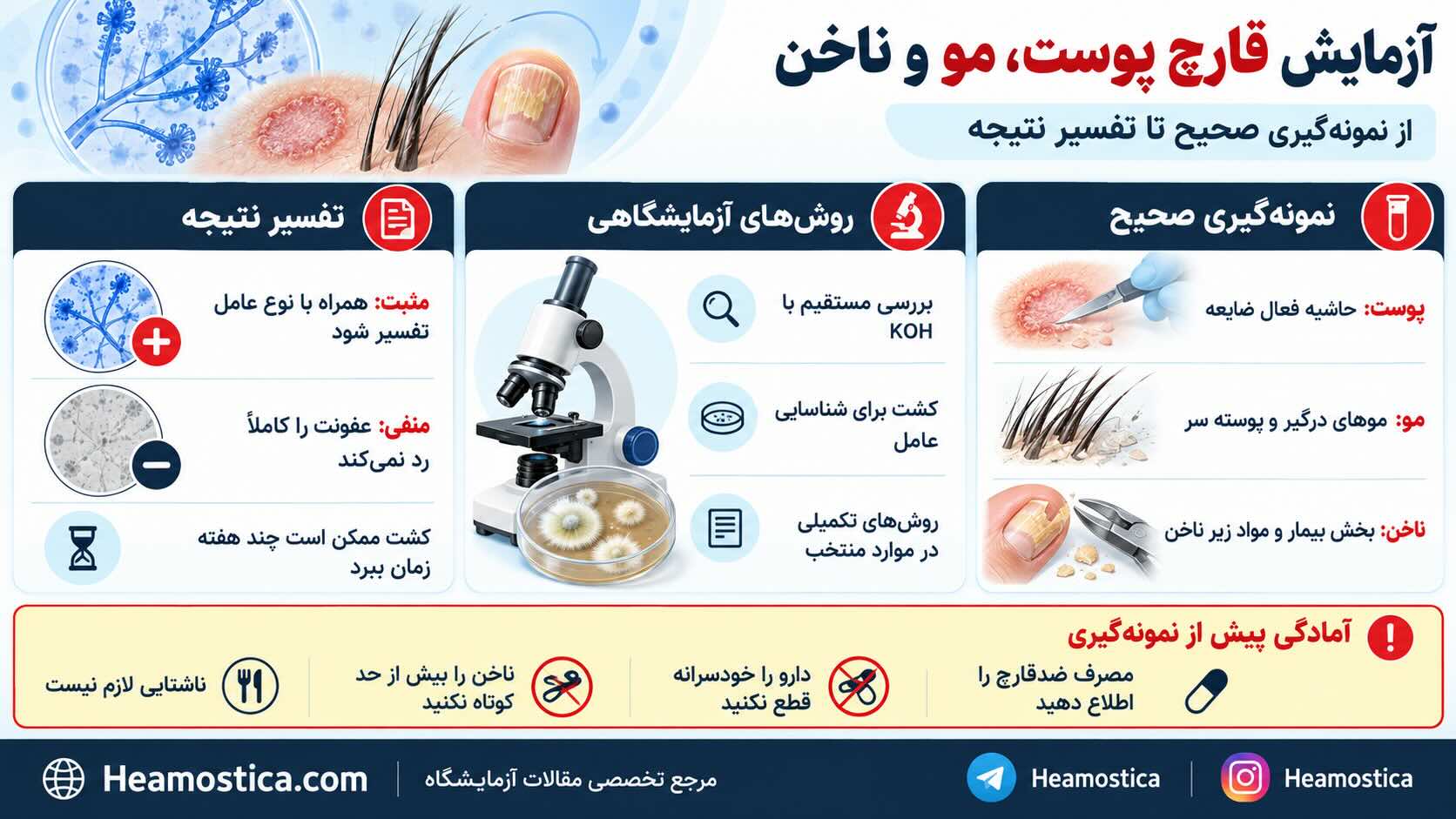 آزمايش قارج