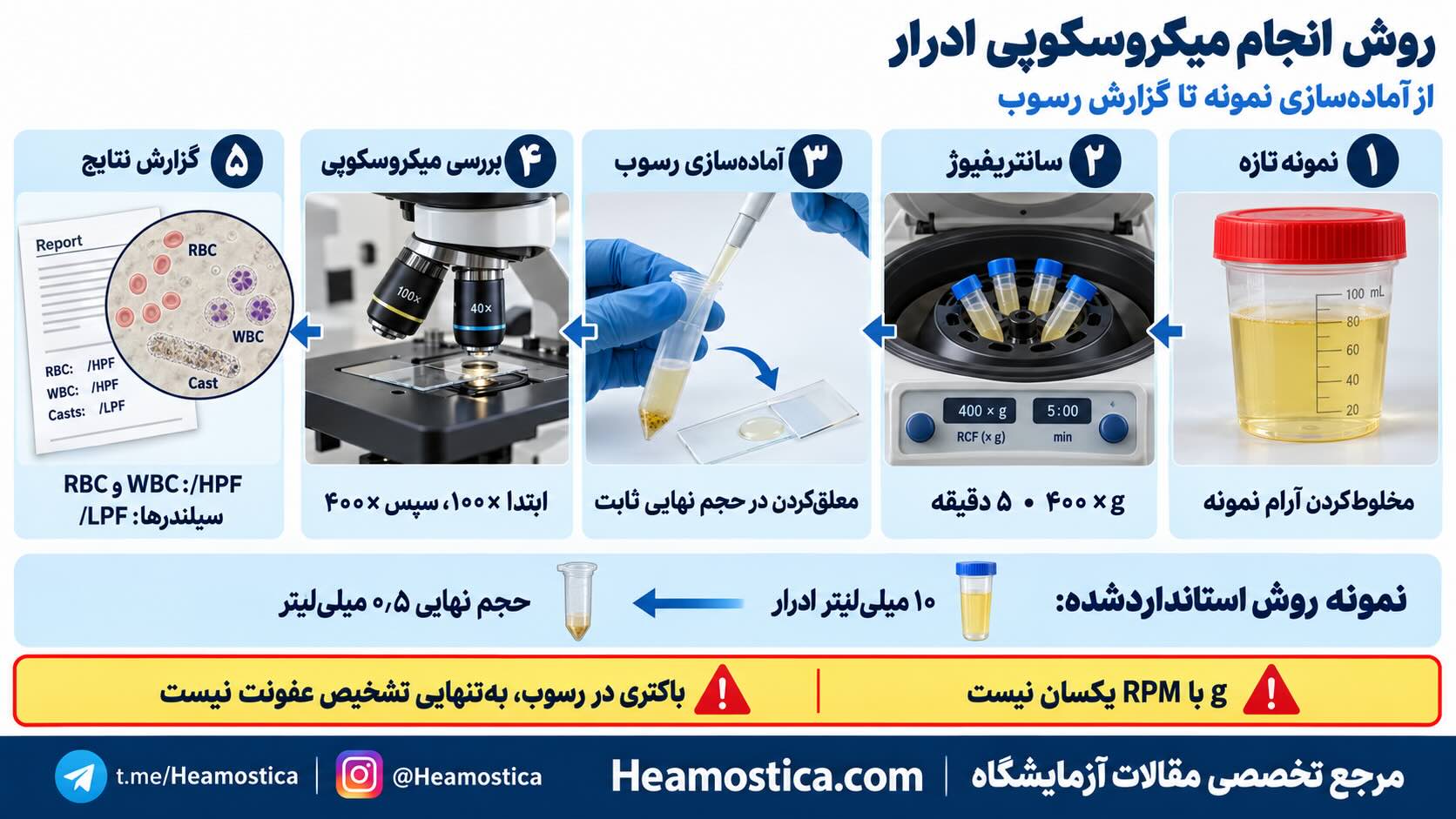 روش انجام ميكروسكوپي ادرار